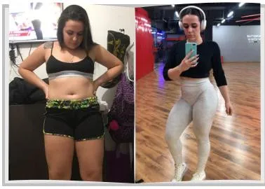 Foto de antes e depois de um paciente do Adriano, lado a lado