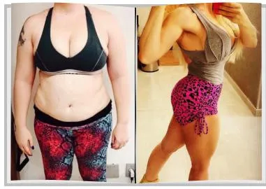 Foto de antes e depois de um paciente do Adriano, lado a lado