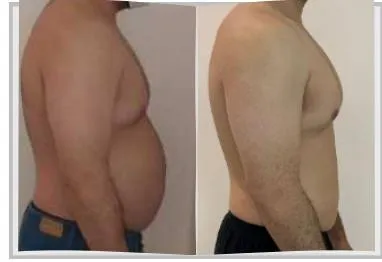 Foto de antes e depois de um paciente do Adriano, lado a lado