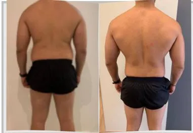 Foto de antes e depois de um paciente do Adriano, lado a lado