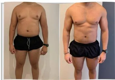 Foto de antes e depois de um paciente do Adriano, lado a lado