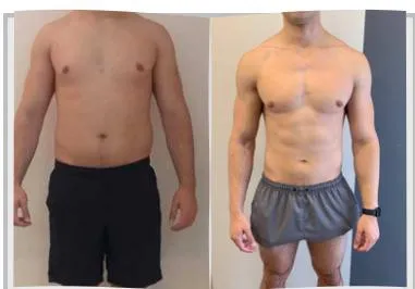 Foto de antes e depois de um paciente do Adriano, lado a lado