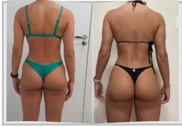 Foto de antes e depois de um paciente do Adriano, lado a lado