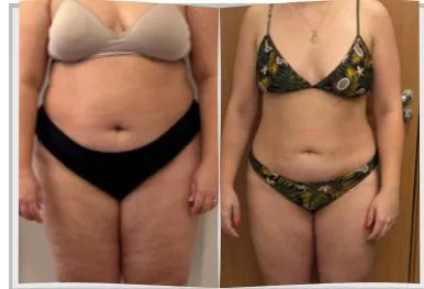 Foto de antes e depois de um paciente do Adriano, lado a lado