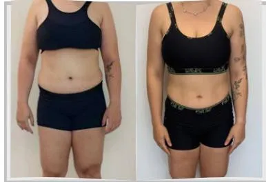 Foto de antes e depois de um paciente do Adriano, lado a lado