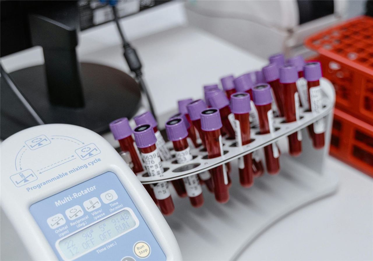 Fazer exames de sangue periódicos é de suma importância no processo de emagrecimento.