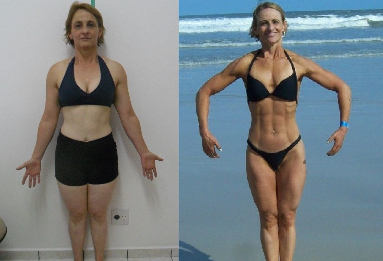 Antes e depois de paciente na definição muscular